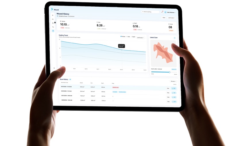 Clinician dashboard on an iPad, tracking a wound's volume, area, and depth across scans (demo data).