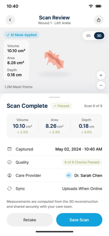 Scan review in the iOS app: automatic wound mask, 3D measurements, quality checks, and sync once back online (demo data).